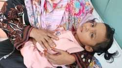 কাটা-ছেঁড়া ছাড়াই ৭ শিশুর হার্টের ছিদ্র বন্ধ করা হয়েছে।